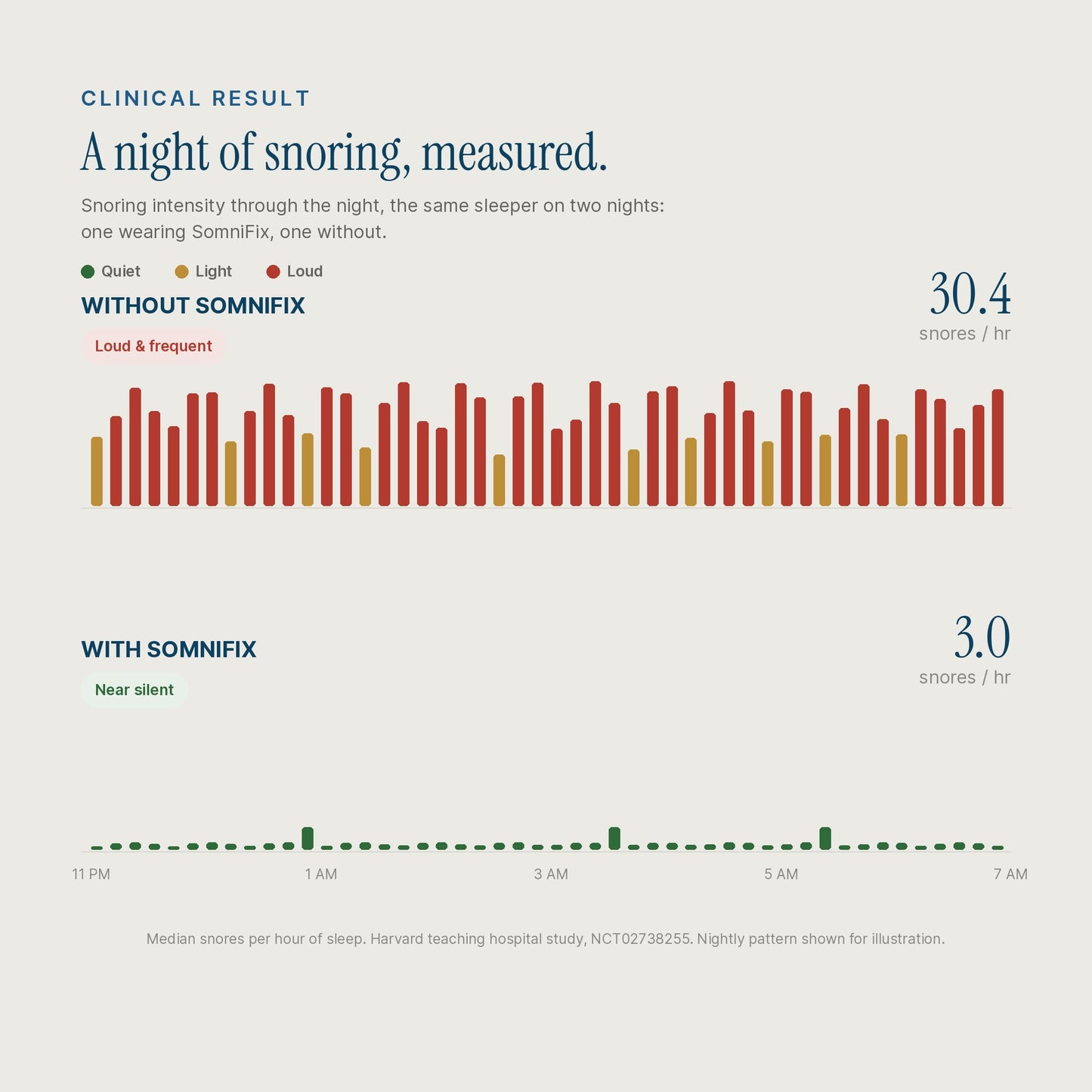 An infographic comparing sleep disturbance with and without SomniFix. The top section shows a bar chart of snoring intensity on a light beige background, with red bars representing loud and yellow bars representing light snoring, labeled 'WITHOUT SOMNIFIX' and showing a score of 30.