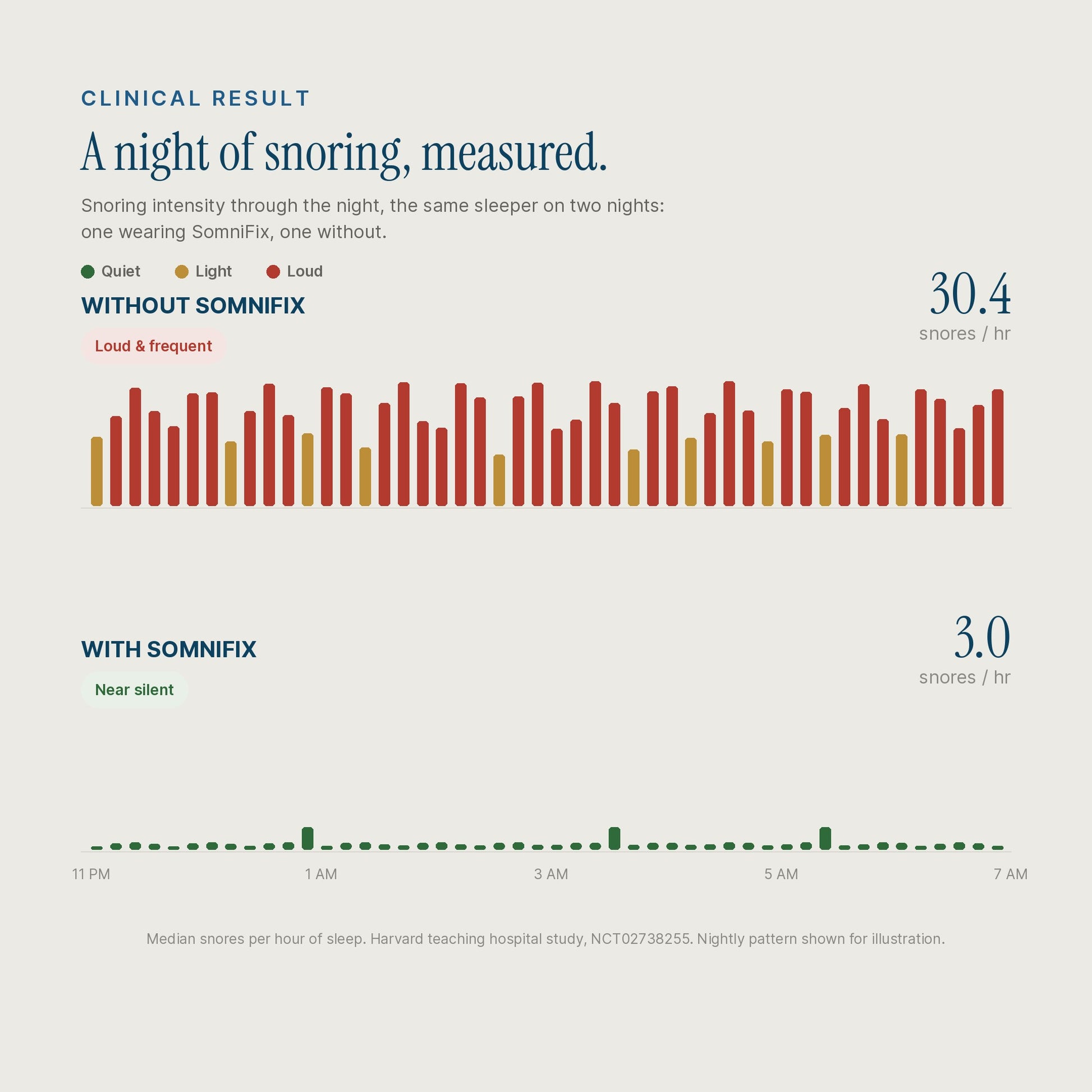 An infographic comparing sleep disturbance with and without SomniFix. The top section shows a bar chart of snoring intensity on a light beige background, with red bars representing loud and yellow bars representing light snoring, labeled 'WITHOUT SOMNIFIX' and showing a score of 30.